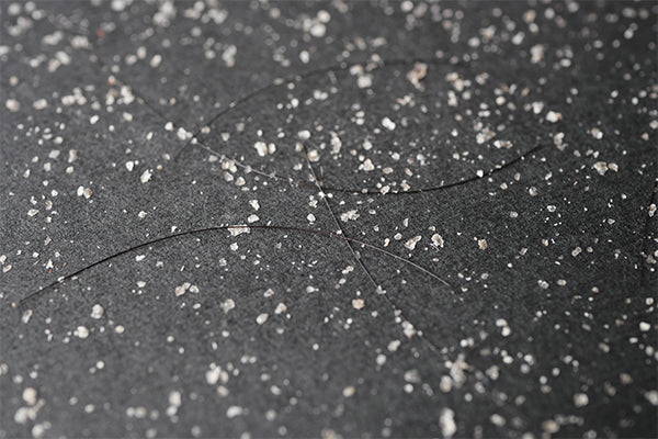 does hair conditioner cause dandruff?