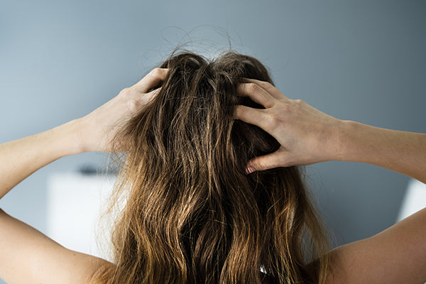 How to Remove Scalp Buildup Naturally