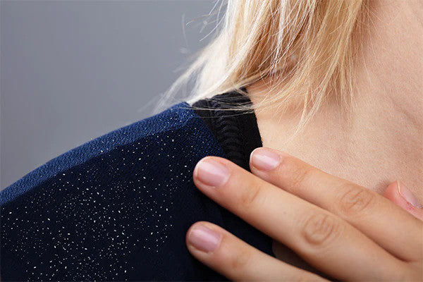 How to Use Onion Juice for Dandruff