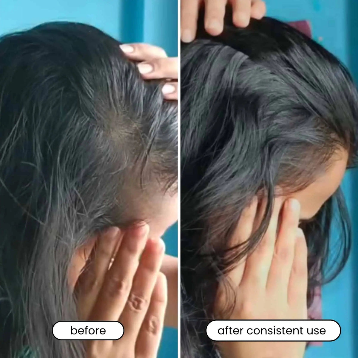 Rosemary Hair Growth Spray