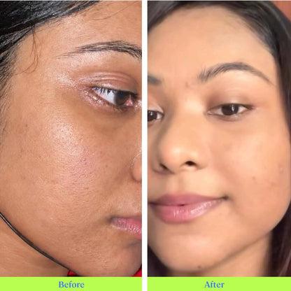 Rice Berry Ceramide Moisturizer