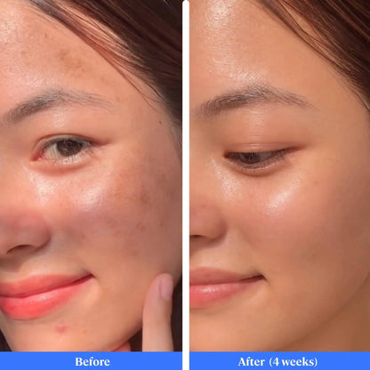 Rice Berry Vitamin C Glow Serum