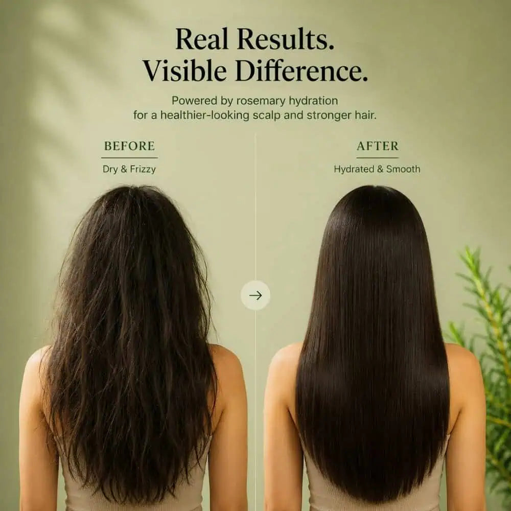 Rosemary Hair Growth Spray