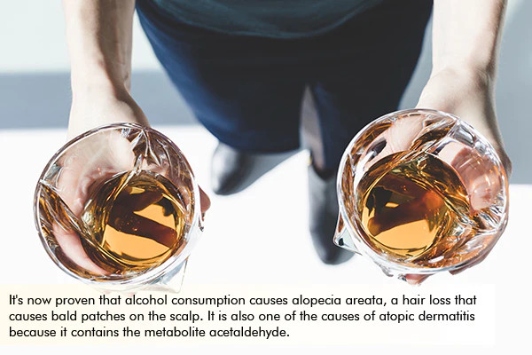 alcohol consumption may lead to hair fall