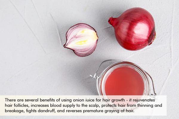how onion juice benefits hair growth