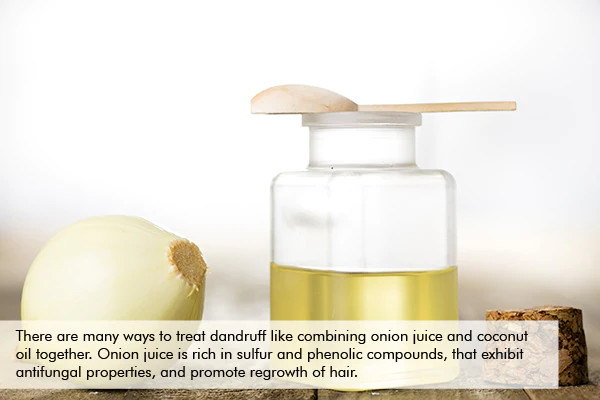 use coconut oil with onion juice for dandruff control